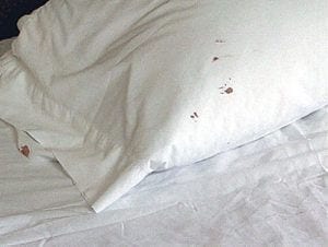 bed bug pillow stains
