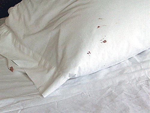 Un oreiller avec des taches de sang après l’alimentation d’une punaise de lit